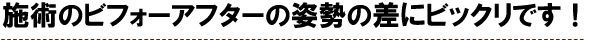 施術のビフォーアフターの姿勢の差にビックリです！